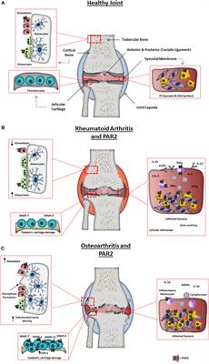 Rheumatic Disease: Protease-Activated Receptor-2 in Synovial Joint Pathobiology